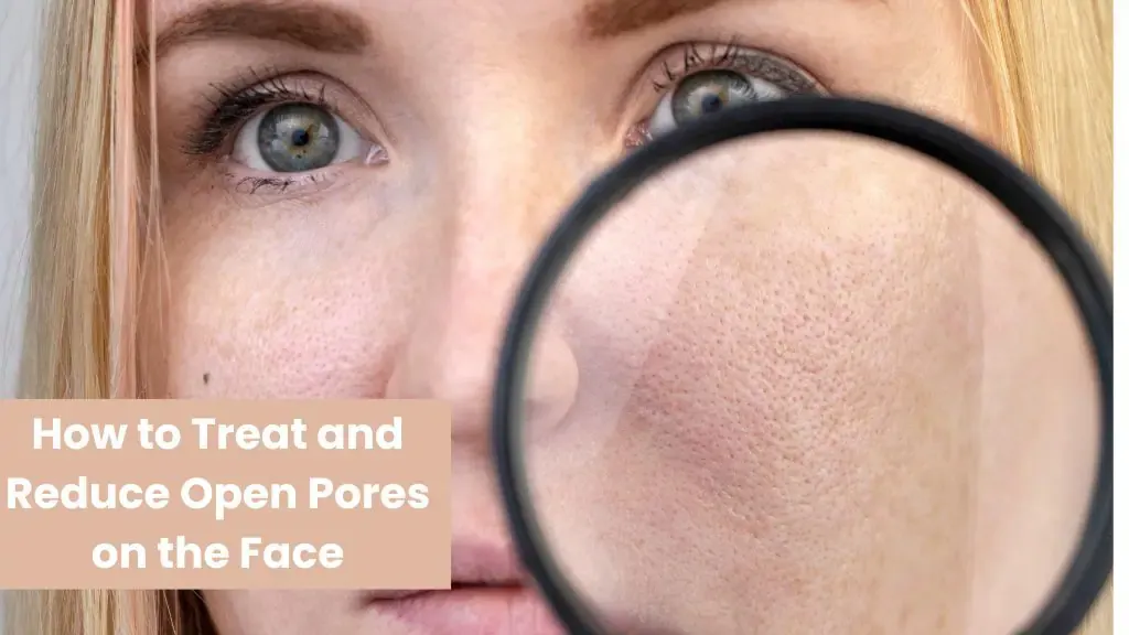 How to Treat and Reduce Open Pores on the Face
