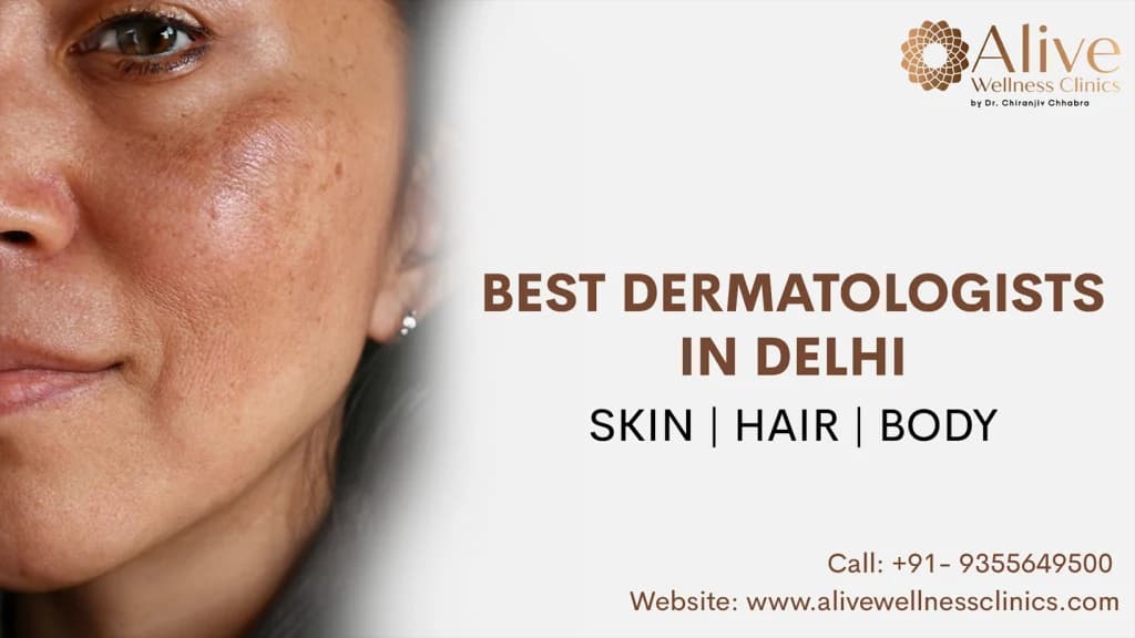 Best Dermatologists in Delhi for Skin