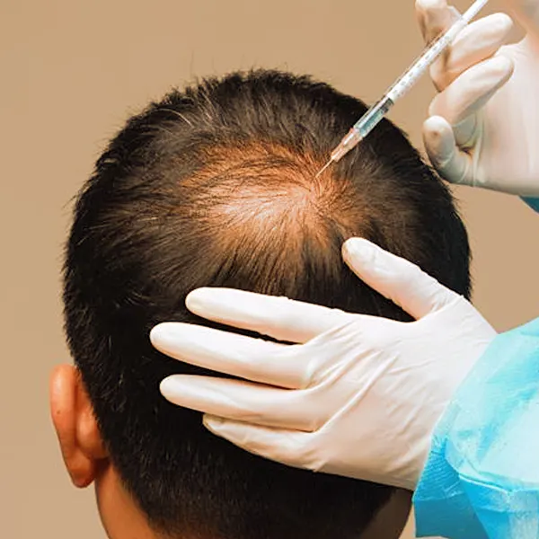 Growth Factor Concentrate (GFC)