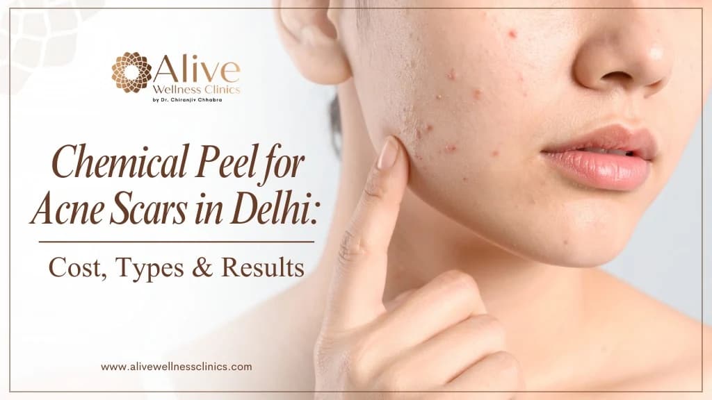 Chemical Peel for Acne Scars in Delhi: Cost, Types & Results