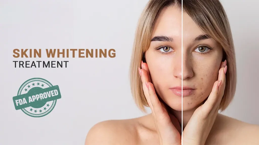 Skin whitening treatment