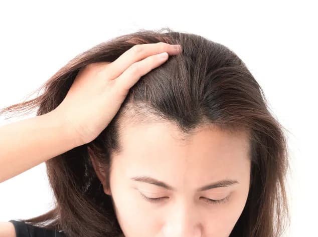 Hair Loss Treatment