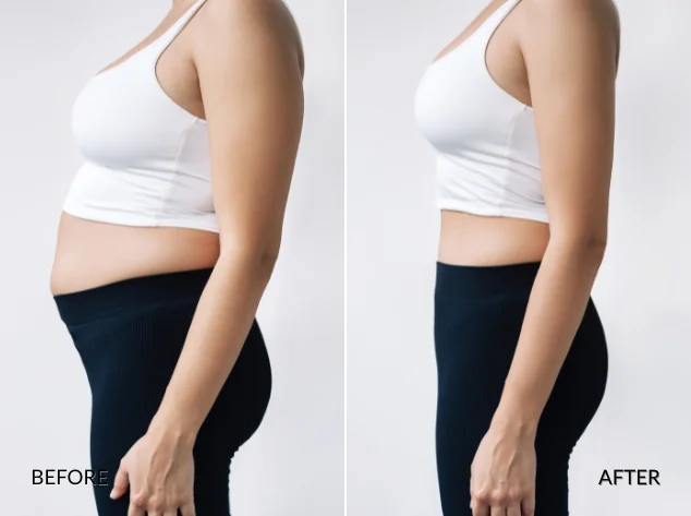 Weight Loss Modalities