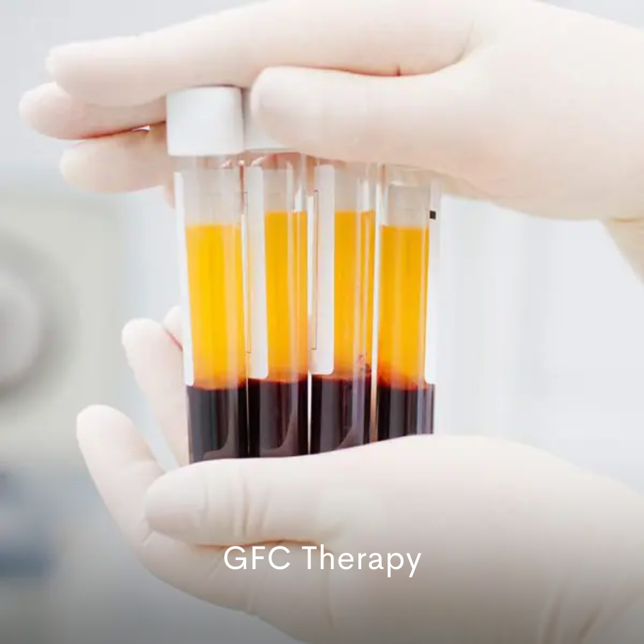 GFC Therapy