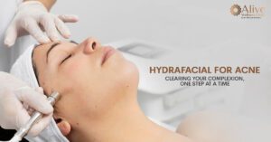 Read more about the article HydraFacial for Acne: Clearing Your Complexion, One Step at a Time