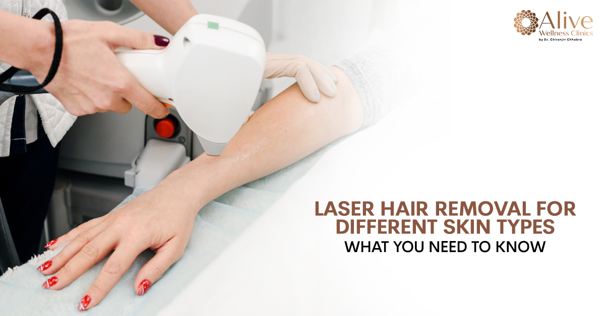 You are currently viewing Laser Hair Removal for different skin types: What you need to know