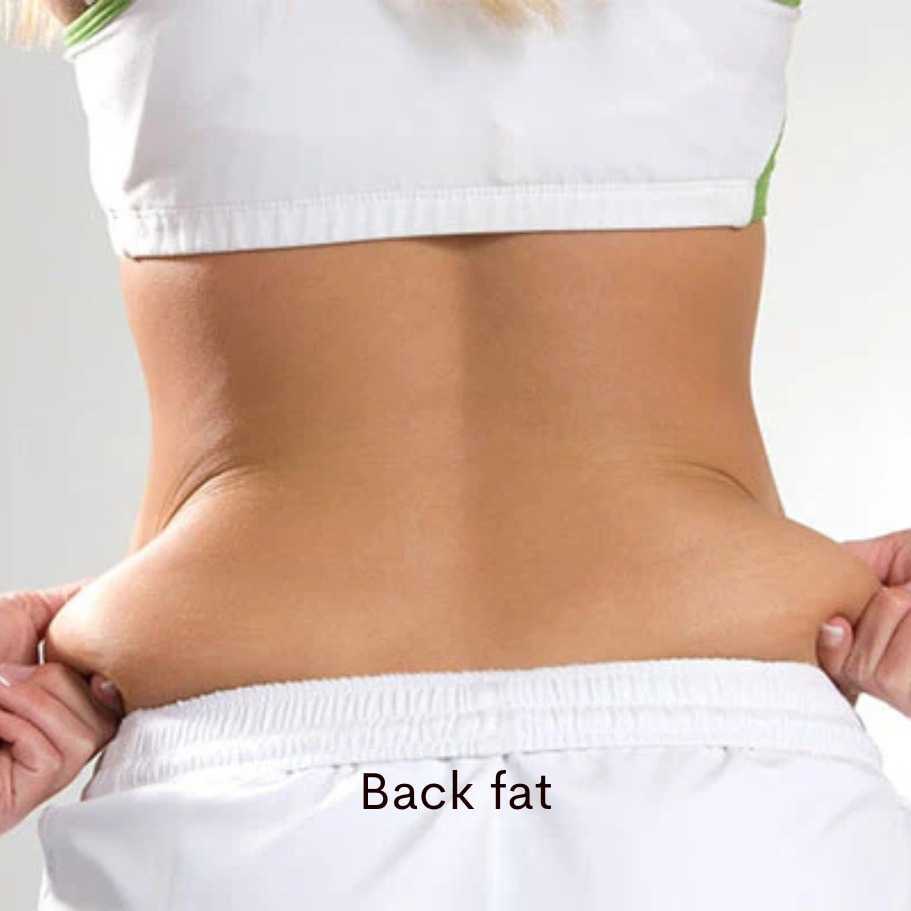 Back Fat