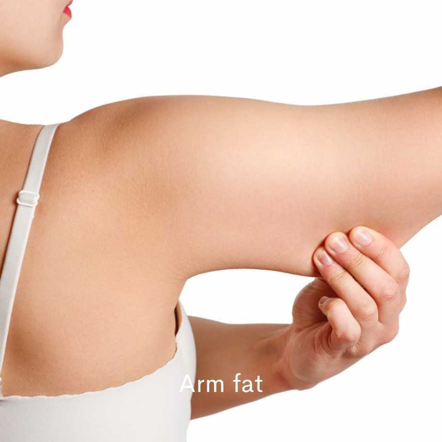 Upper Arms