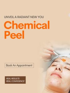 website banner- mobile - Chemical Peel