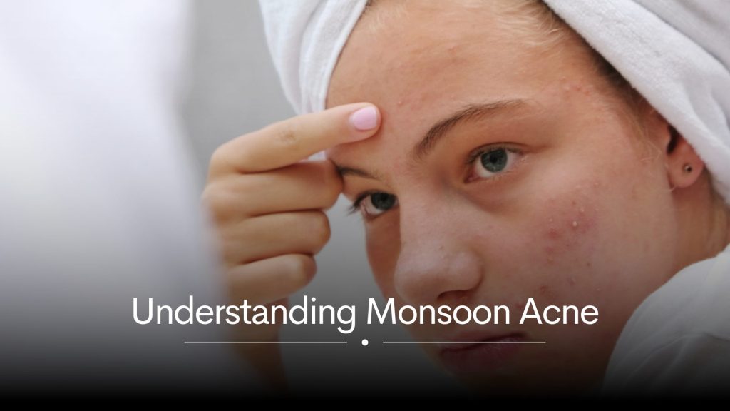 What is monsoon ace?