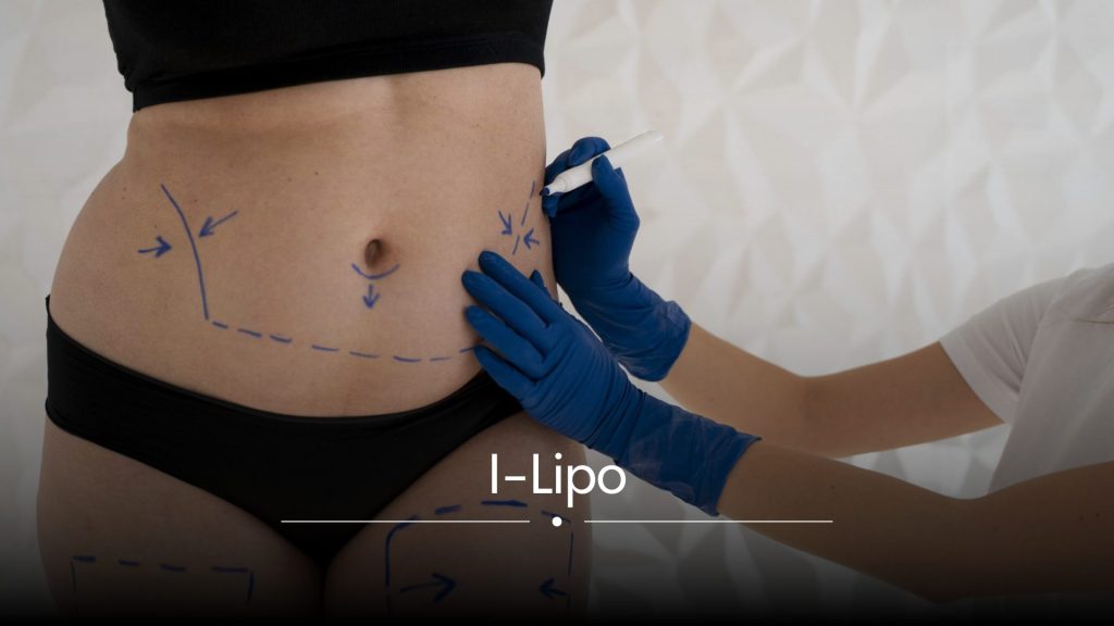 I-Lipo as effective fat loss trio