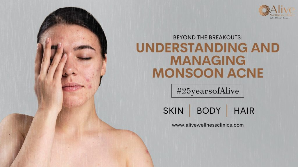 Beyond the Breakouts: Understanding and Managing Monsoon Acne