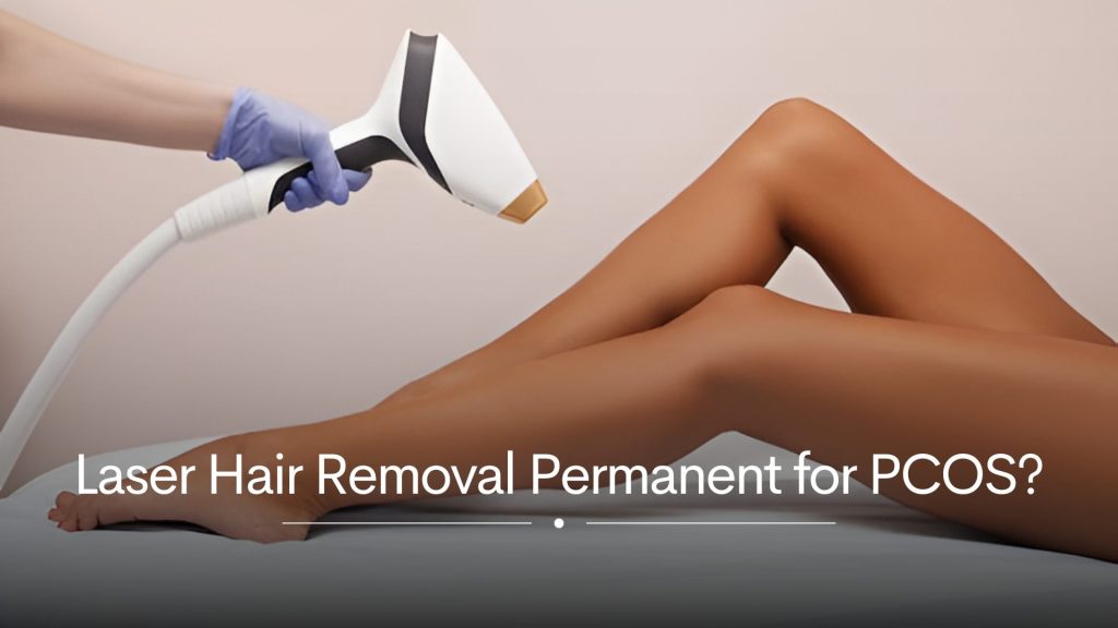 Laser Hair Removal Permanent for PCOS