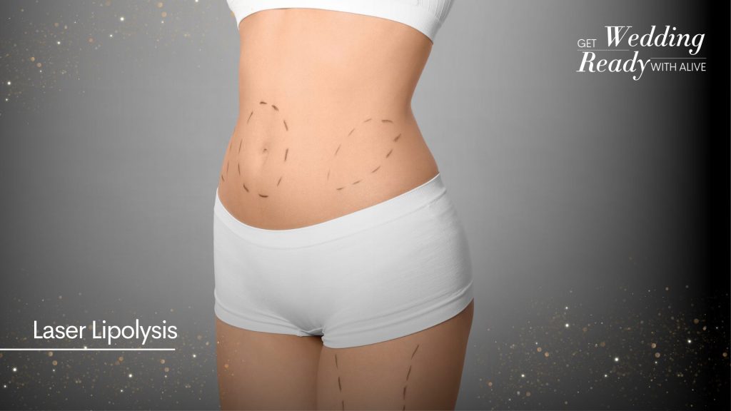 Laser Lipolysis as one of the weight loss treatments