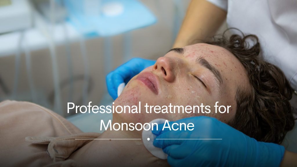 Treatments for acne in monsoon