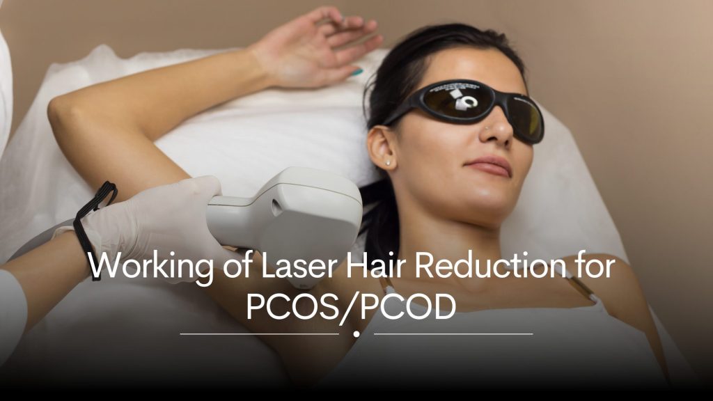 Working of Laser Hair Reduction for PCOS/PCOD