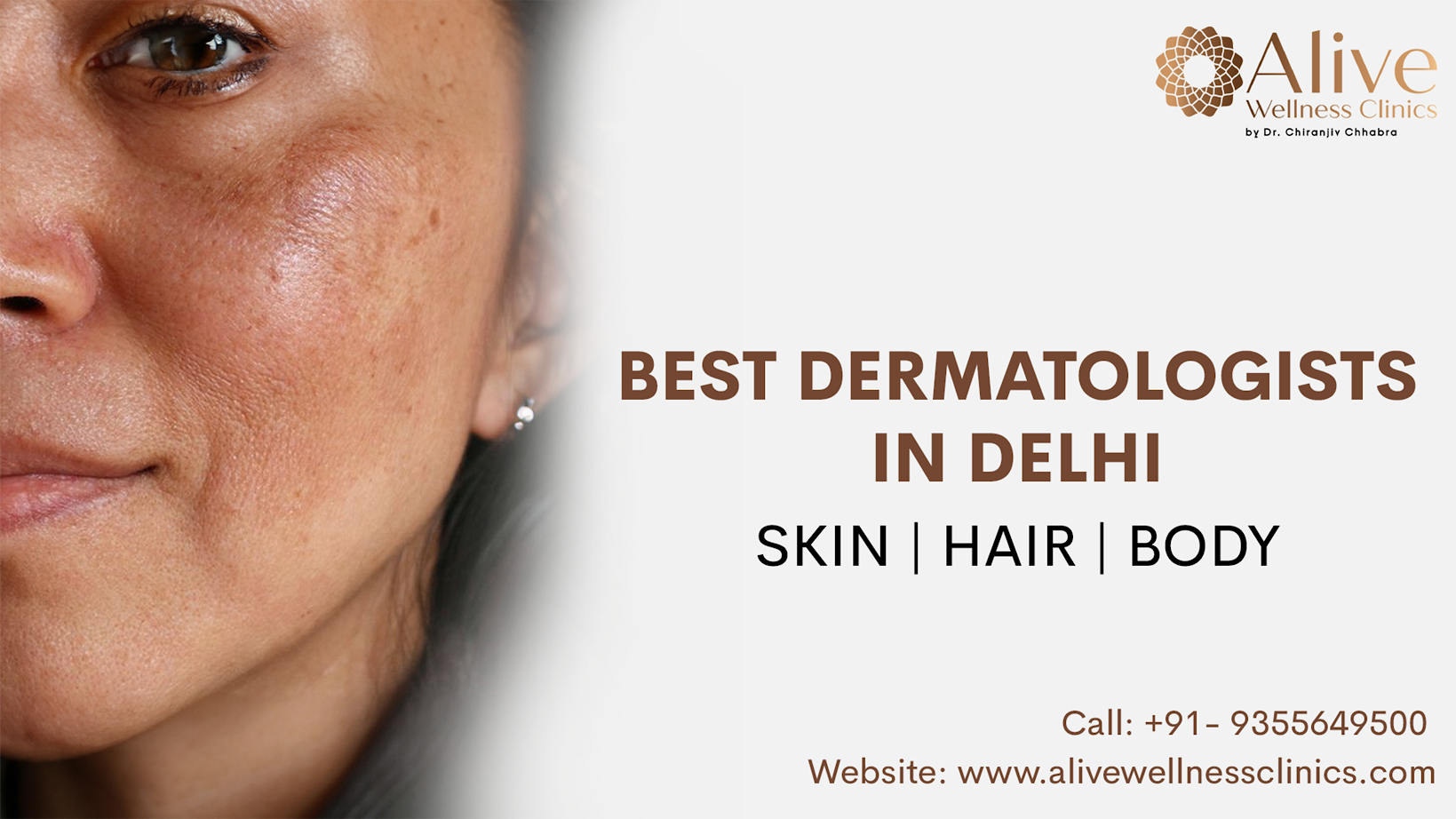 Best Dermatologists in Delhi - Alive Wellness Clinic