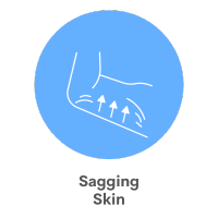 Sagging Skin