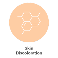 Skin Discoloration