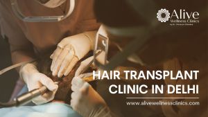 hair transplant clinic in Delhi ncr