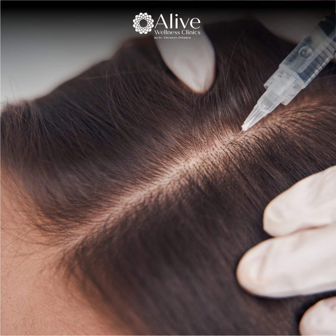 Arthrex ACP PRP Hair Treatment