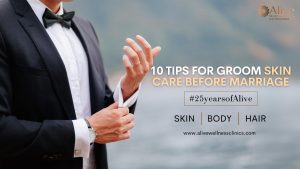 Tips For Groom Skin Care Before Marriage