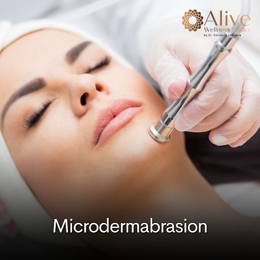 Microdermabrasion Treatment