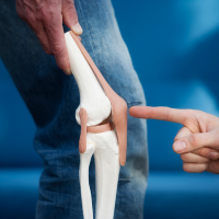 Osteoarthritis Treatment