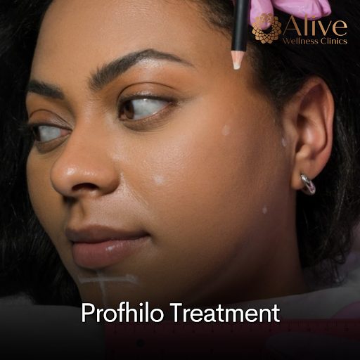 Profhilo Treatment