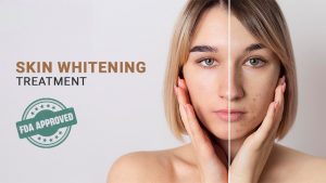 types of skin whitening treatment