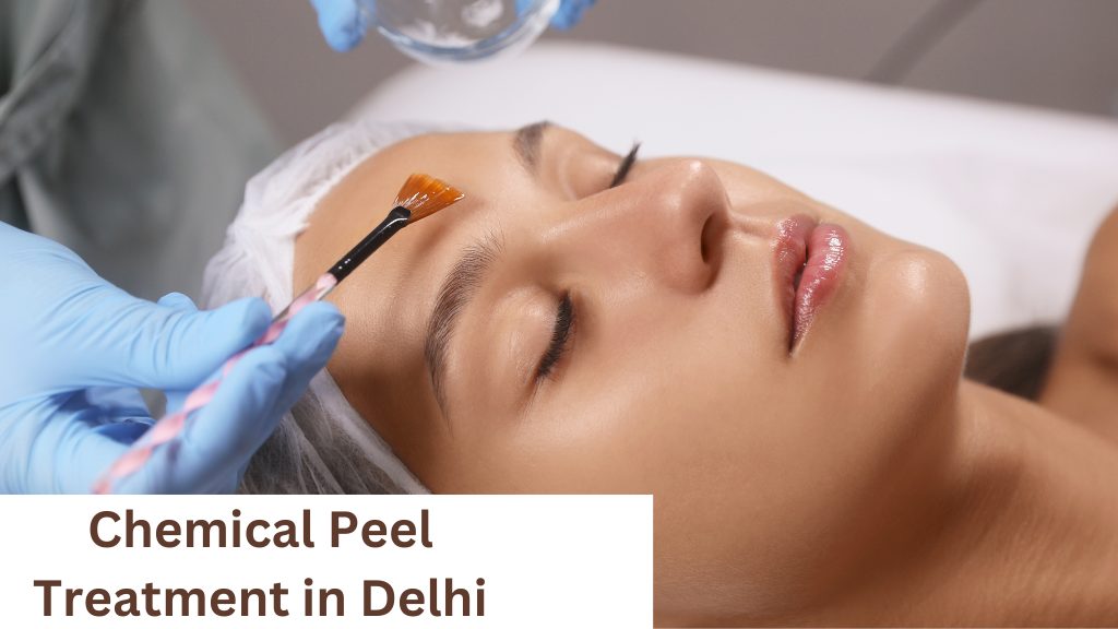 Chemical Peel Treatment in Delhi