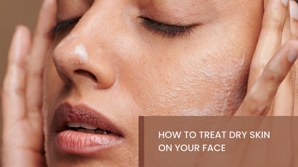 Treat Dry Skin on Your Face