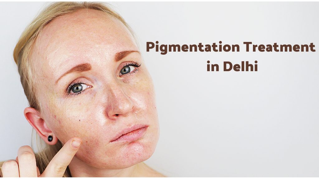 Pigmentation Treatment in Delhi