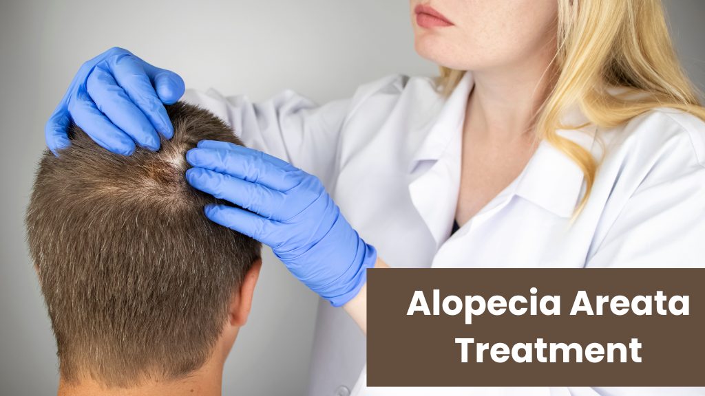 Alopecia Areata Treatment