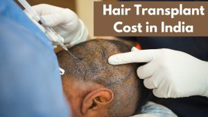 Hair Transplant Cost in India