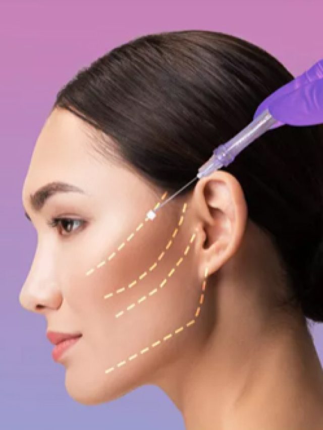 Thread Lift Treatment in Delhi