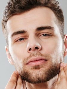 Beard Implant in Delhi