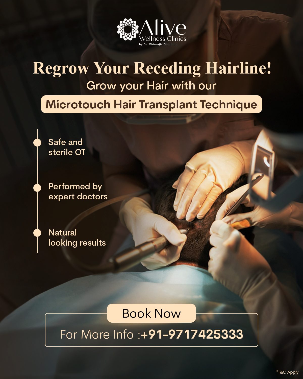 Hair Transplant