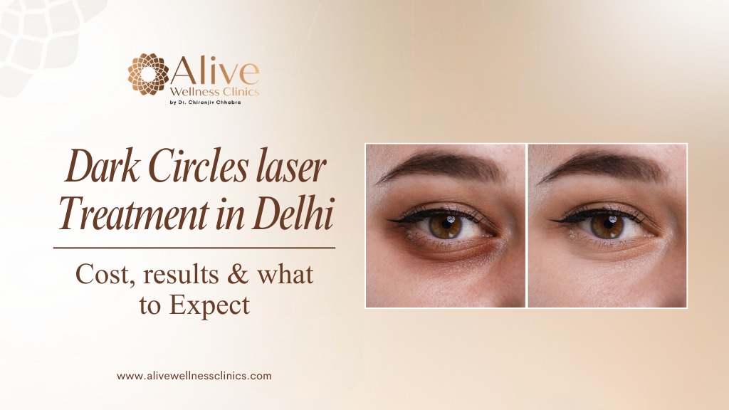Dark Circle Laser Treatment in Delhi